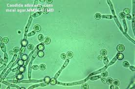 candida diet - picture of candida under microscope